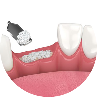 Failing Old Oral Work Image