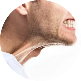Jaw Clenchers Image