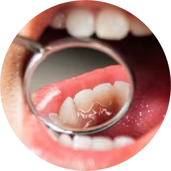 Oral Function Issues Image