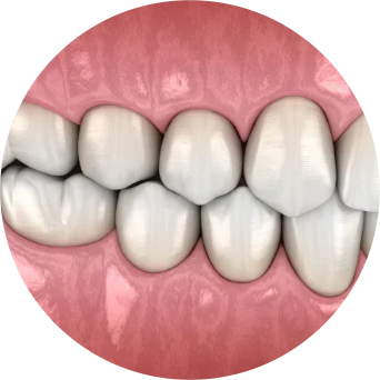 Poor Occlusion Image