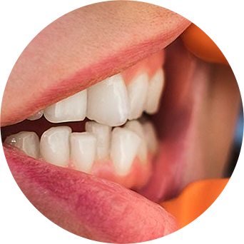 Unclear Speech Image