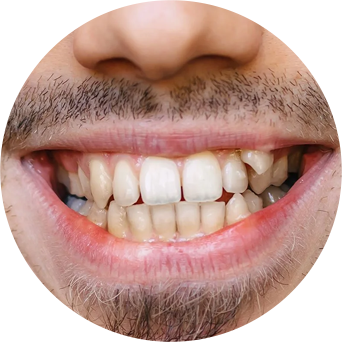 Uneven Tooth Shape/Size Image