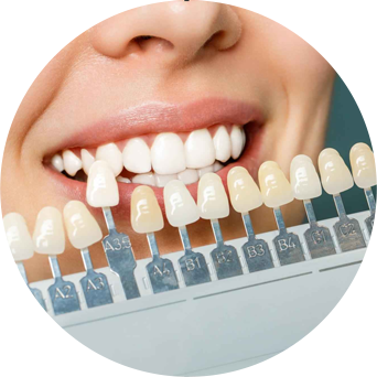 Porcelain & Composite Veneers Image