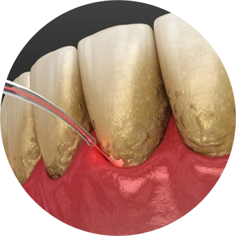 Cleaning Procedures Image
