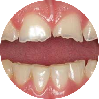 Noisy Grinding Image