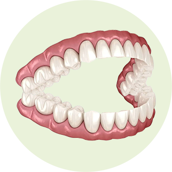 Full Mouth Basal Image
